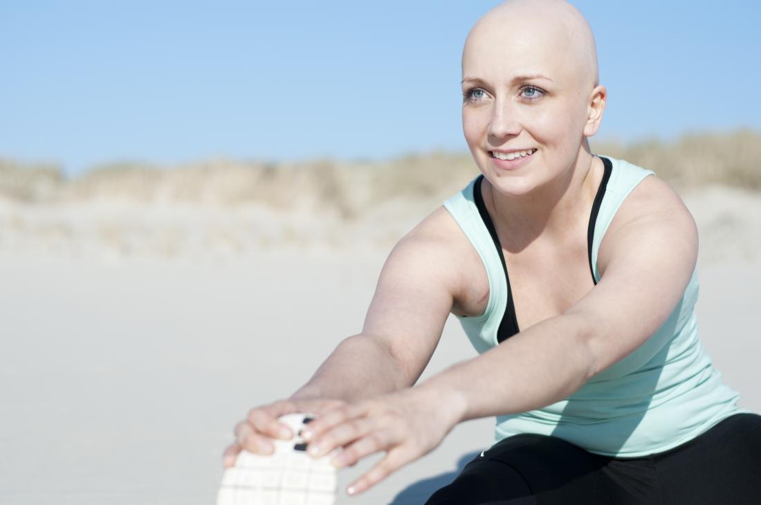 alopecia